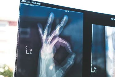 Röntgenbild einer Hand