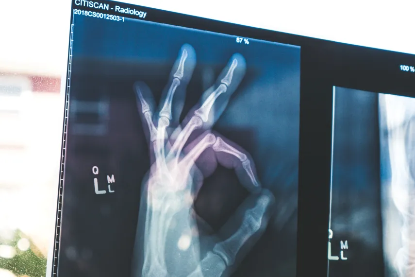 Röntgenbild einer Hand